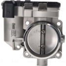 NISSENS Drosselklappenstutzen 955079 FIRST FIT