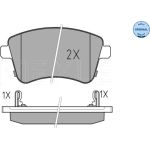 Bremsbelagsatz Kia P. Venga 10- Mit Sensor 025 251 8419/W Bremsbelagsatz Kia P. Venga 10- Mit Sensor 025 251 8419/W