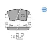 Bremsbelagsatz Hyundai T. I40 11-/Sonata 08-/Ceed 12- Mit Sensor 025 253 3715/W Bremsbelagsatz Hyundai T. I40 11-/Sonata 08-/Ceed 12- Mit Sensor 025 253 3715/W