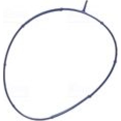 NISSENS Drosselklappenstutzen NISSENS Drosselklappenstutzen