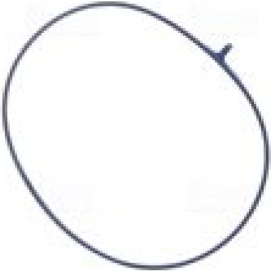 955193 Drosselklappenstutzen ** FIRST FIT **