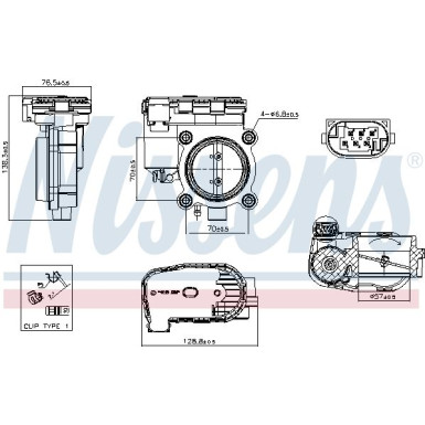 NISSENS Drosselklappenstutzen 955247 FIRST FIT