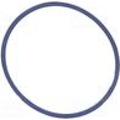 NISSENS Drosselklappenstutzen 955032 FIRST FIT