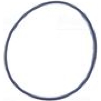 NISSENS Drosselklappenstutzen 955120