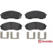 BREMBO Bremsklötze VA | HYUNDAI H-1 KIA Carnival 05 | P 30 041 BREMBO Bremsklötze VA | HYUNDAI H-1 KIA Carnival 05 | P 30 041