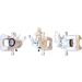 Tauschbremssattel VW Caddy III 1.2 TSI 10 4249320 Tauschbremssattel VW Caddy III 1.2 TSI 10 4249320